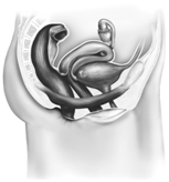 Beskrivelse findes i billedtekst og br&oslash;dtekst.